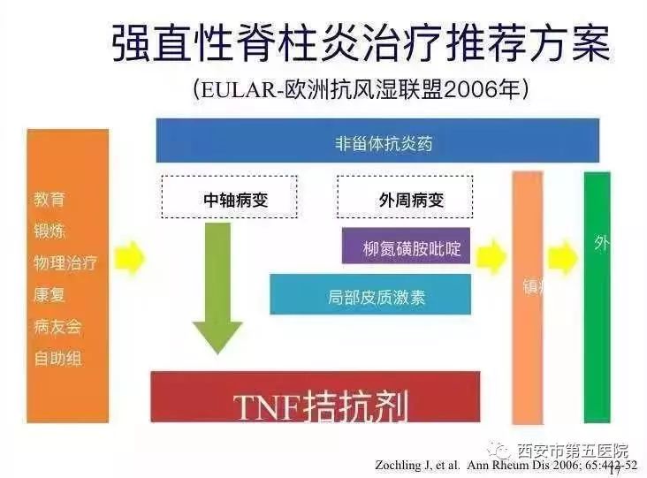 強直性脊柱炎最新進展